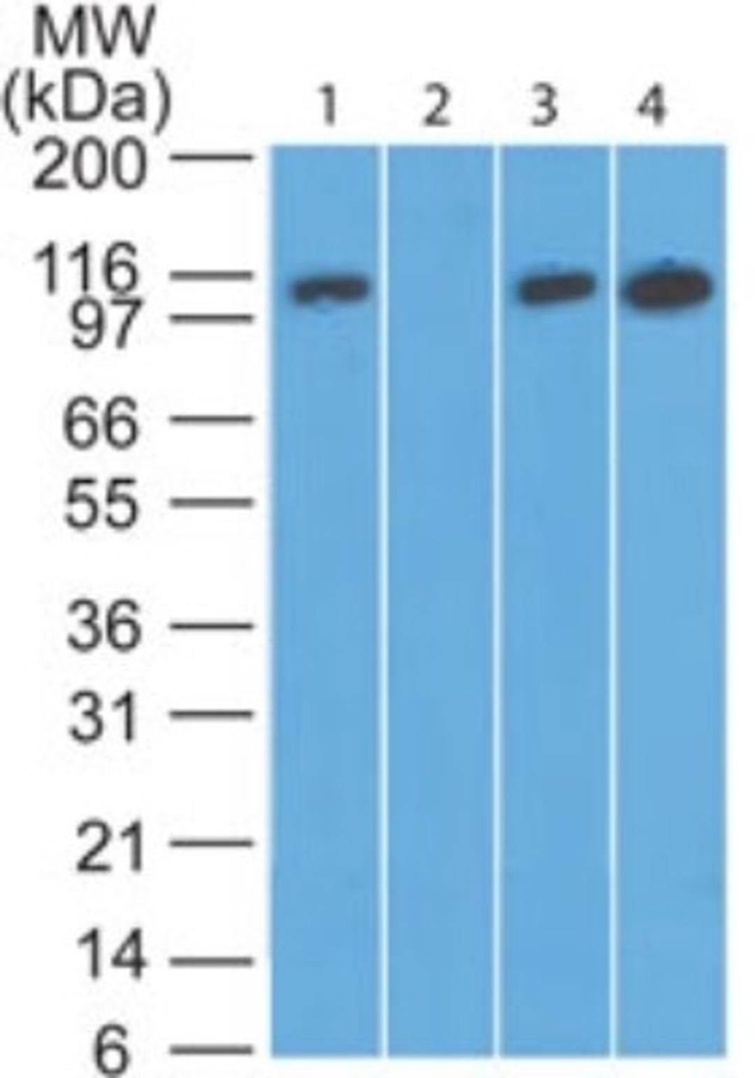 Western Blot: DAAM2 Antibody [NBP2-24536] - Analysis of human skeletal muscle lysate in the 1) absence and 2) presence of immunizing peptide, 3) mouse skeletal muscle and 4) rat skeletal muscle probed with DAAM2 antibody at 0.5 ug/ml.  Goat anti-rabbit Ig HRP secondary antibody and PicoTect ECL substrate solution were used for this test.