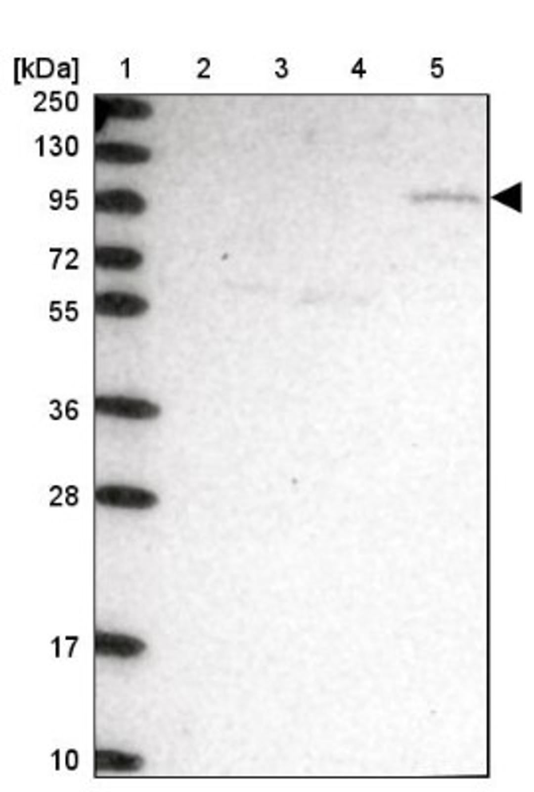 Western Blot: CLCN3 Antibody [NBP1-91790] - Lane 1: Marker [kDa] 250, 130, 95, 72, 55, 36, 28, 17, 10<br/>Lane 2: Human cell line RT-4<br/>Lane 3: Human cell line U-251MG sp<br/>Lane 4: Human plasma (IgG/HSA depleted)<br/>Lane 5: Human liver tissue