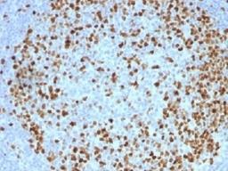 IHC testing of FFPE human tonsil with TOP2A antibody (clone TOP2A/1362). Required HIER: boil sections in 10mM citrate buffer, pH6, for 10-20 min followed by cooling at RT for 20 min.