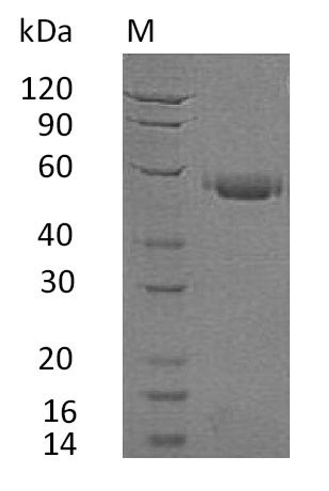 (Tris-Glycine gel) Discontinuous SDS-PAGE (reduced) with 5% enrichment gel and 15% separation gel.