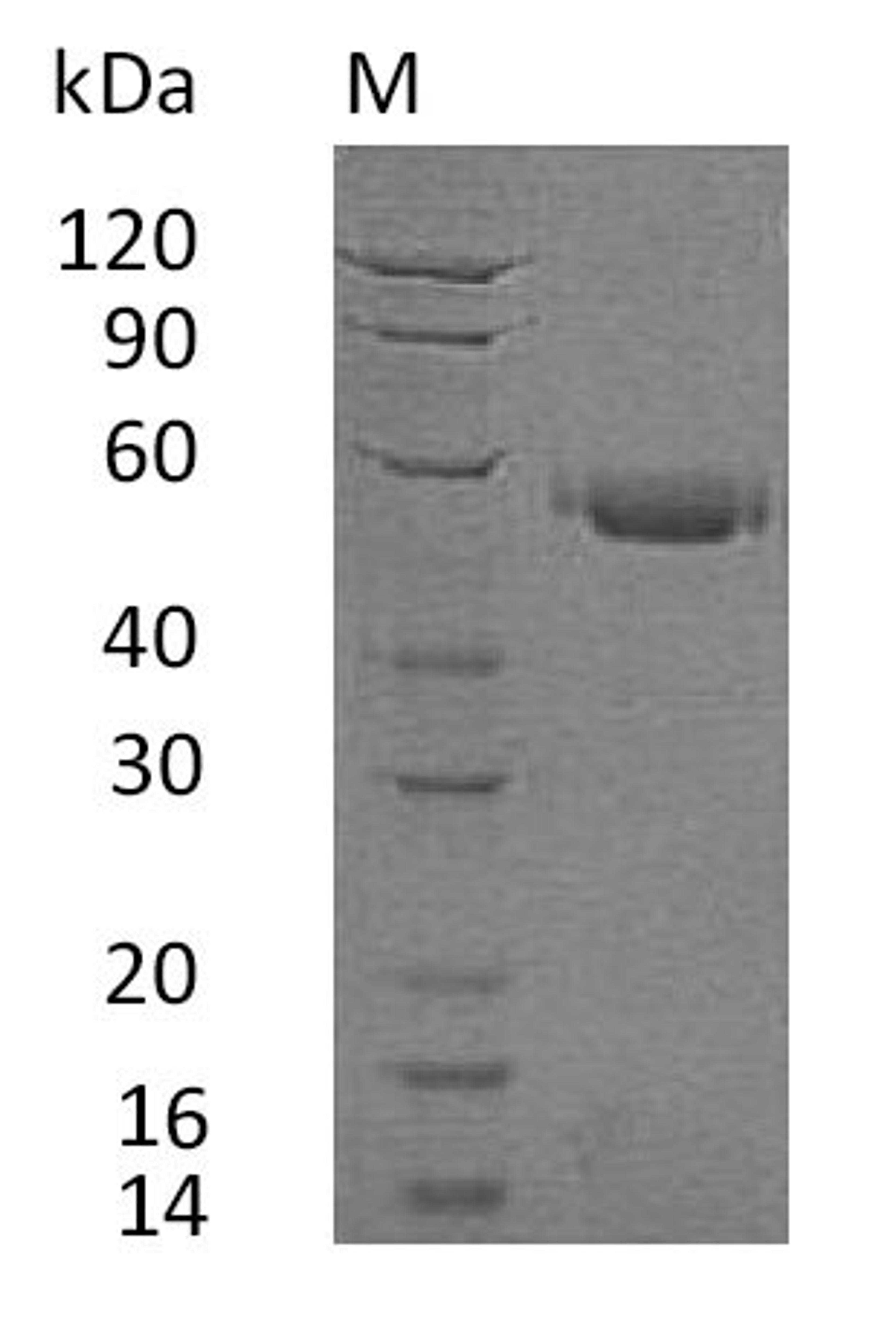 (Tris-Glycine gel) Discontinuous SDS-PAGE (reduced) with 5% enrichment gel and 15% separation gel.