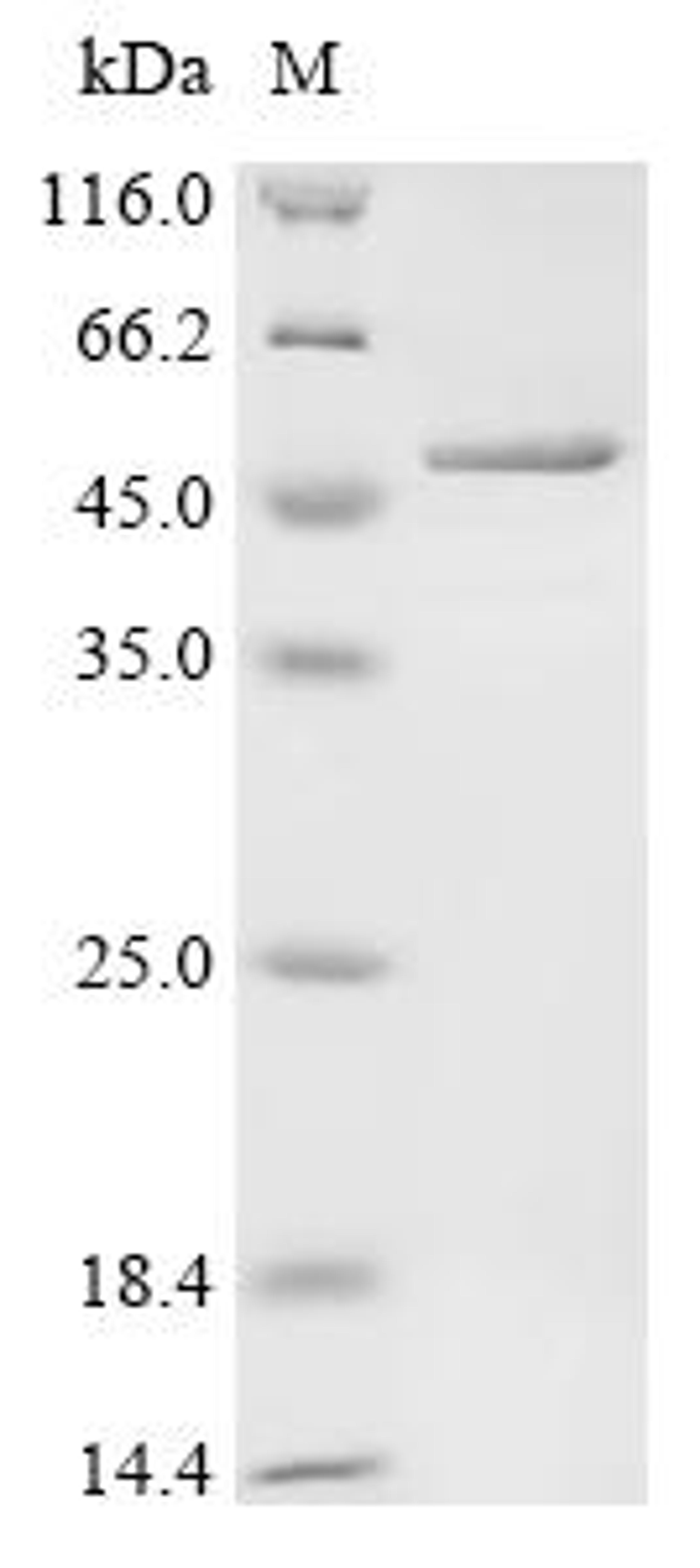 (Tris-Glycine gel) Discontinuous SDS-PAGE (reduced) with 5% enrichment gel and 15% separation gel.