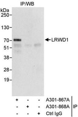 Detection of human LRWD1 by western blot of immunoprecipitates.