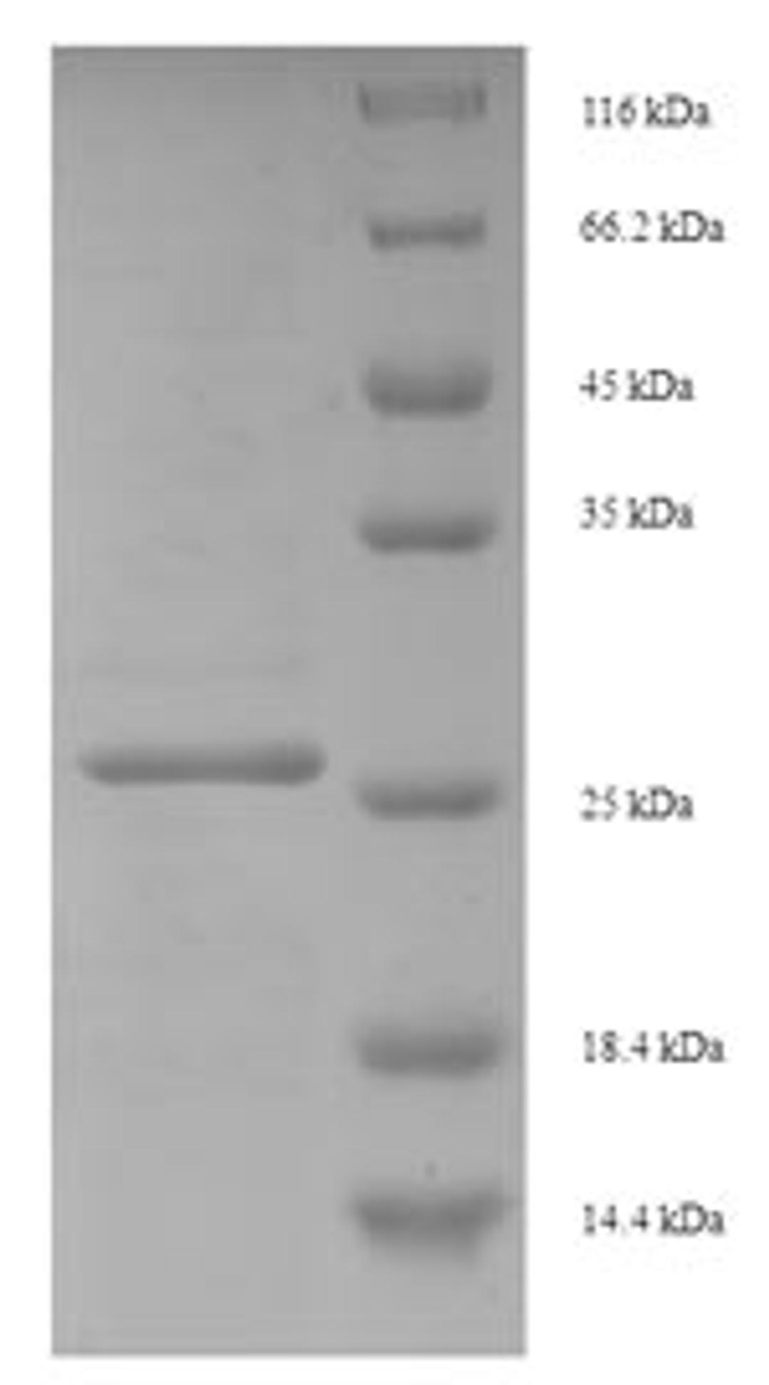 (Tris-Glycine gel) Discontinuous SDS-PAGE (reduced) with 5% enrichment gel and 15% separation gel.