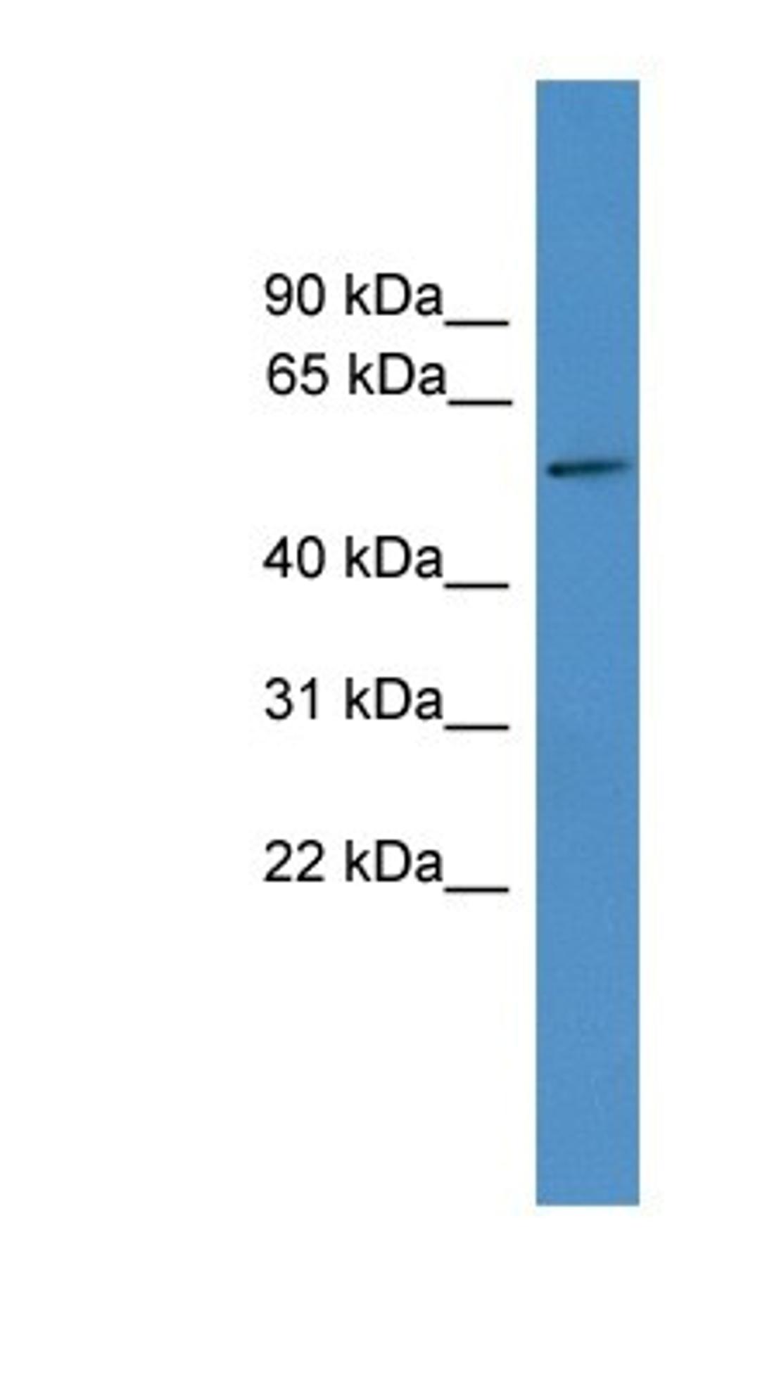 Western Blot: TTYH3 Antibody [NBP1-91350] - Human kidney lysate, concentration 0.2-1 ug/ml.