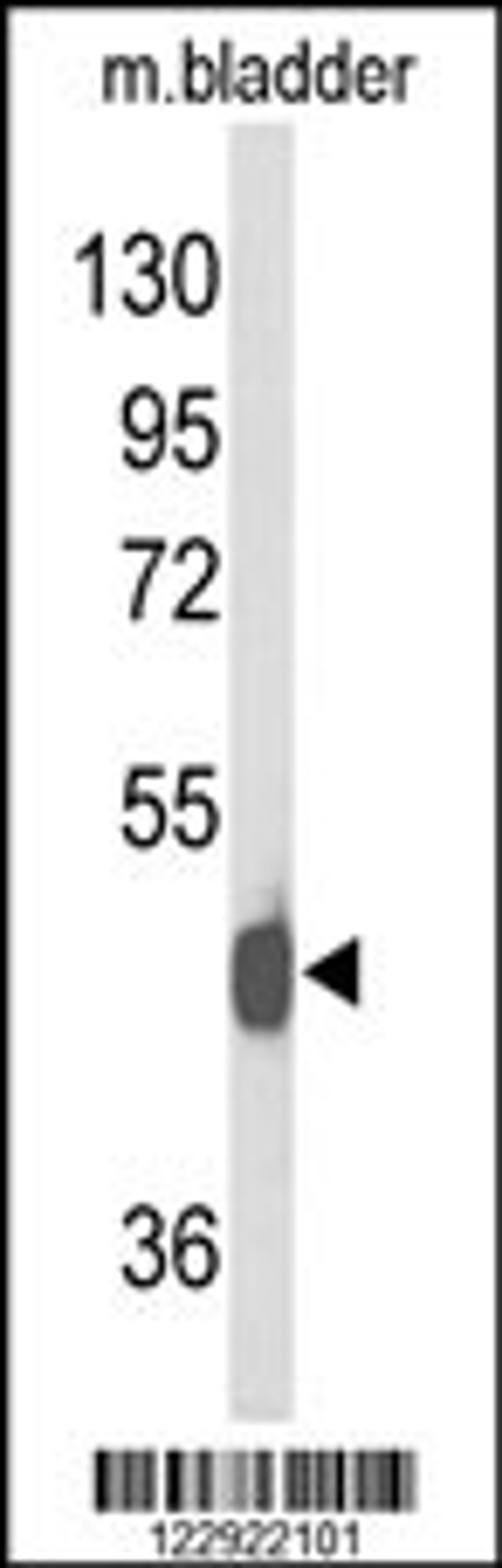 Western blot analysis of NPY2R Antibody in mouse bladder tissue lysates (35ug/lane)