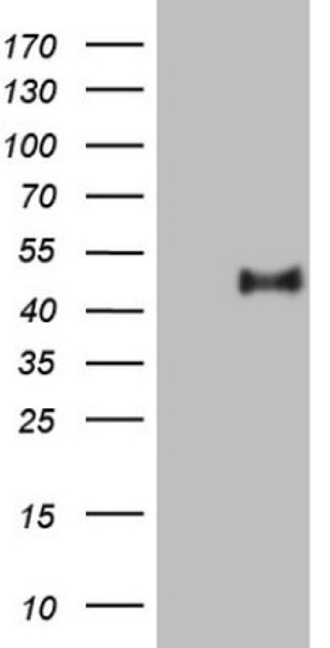 Western Blot: PON3 Antibody (5C3) [NBP2-45370] - Analysis of HEK293T cells were transfected with the pCMV6-ENTRY control (Left lane) or pCMV6-ENTRY PON3.