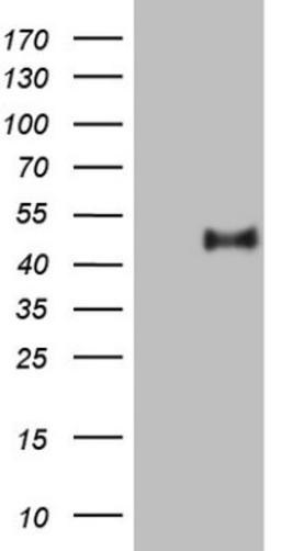 Western Blot: PON3 Antibody (5C3) [NBP2-45370] - Analysis of HEK293T cells were transfected with the pCMV6-ENTRY control (Left lane) or pCMV6-ENTRY PON3.