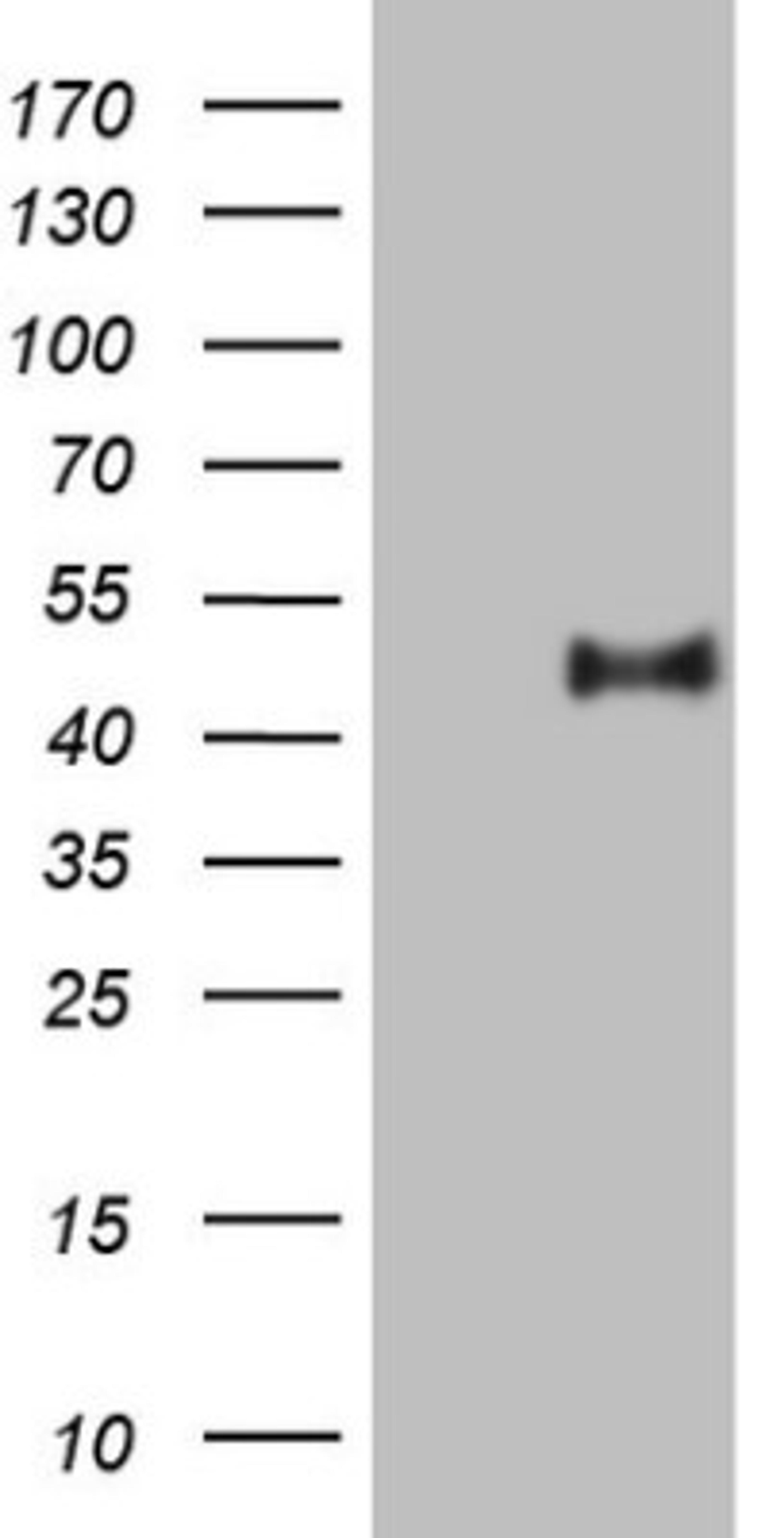 Western Blot: PON3 Antibody (5C3) [NBP2-45370] - Analysis of HEK293T cells were transfected with the pCMV6-ENTRY control (Left lane) or pCMV6-ENTRY PON3.