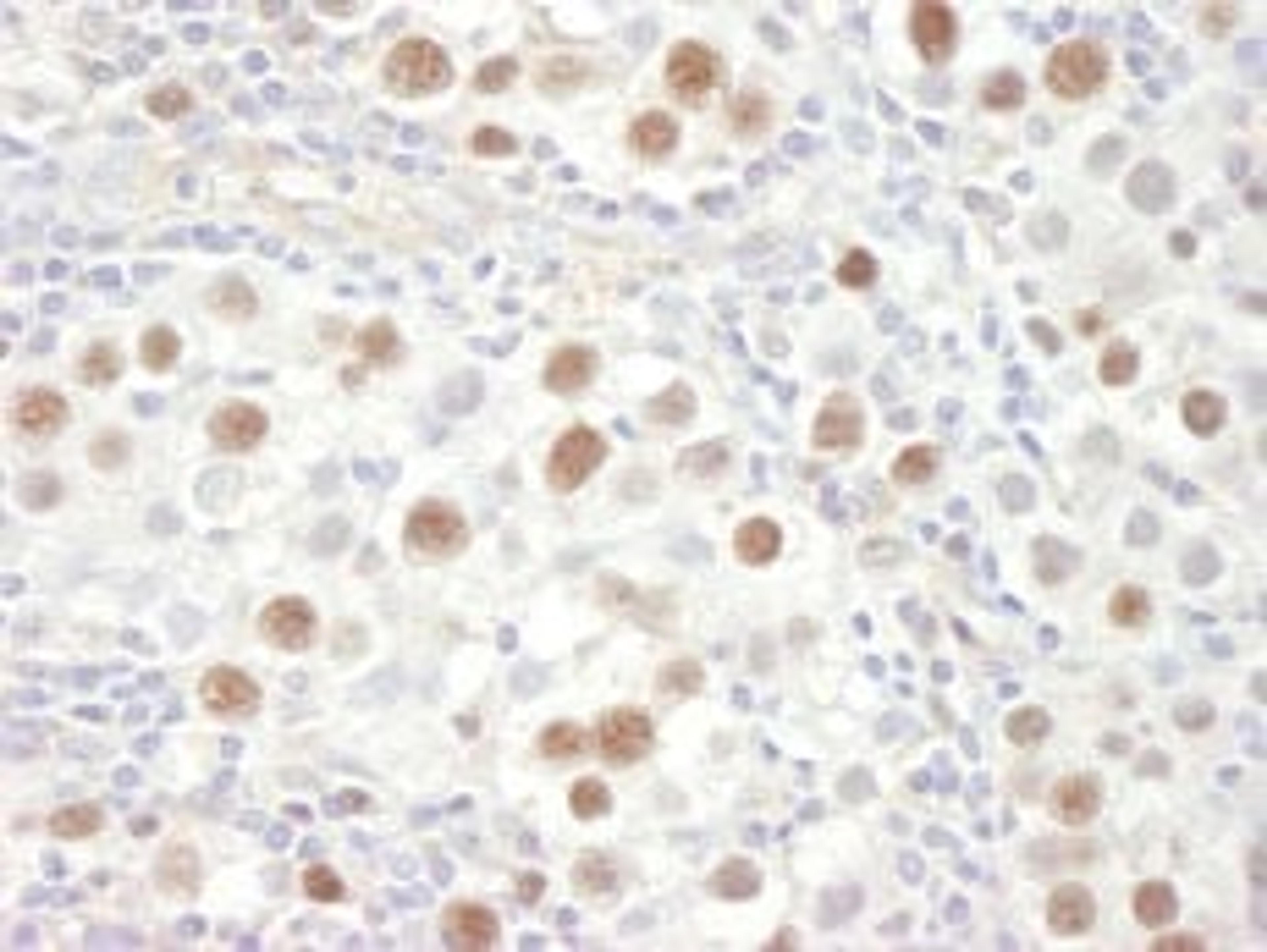 Detection of human MCM4 by immunohistochemistry.