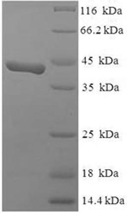 (Tris-Glycine gel) Discontinuous SDS-PAGE (reduced) with 5% enrichment gel and 15% separation gel.