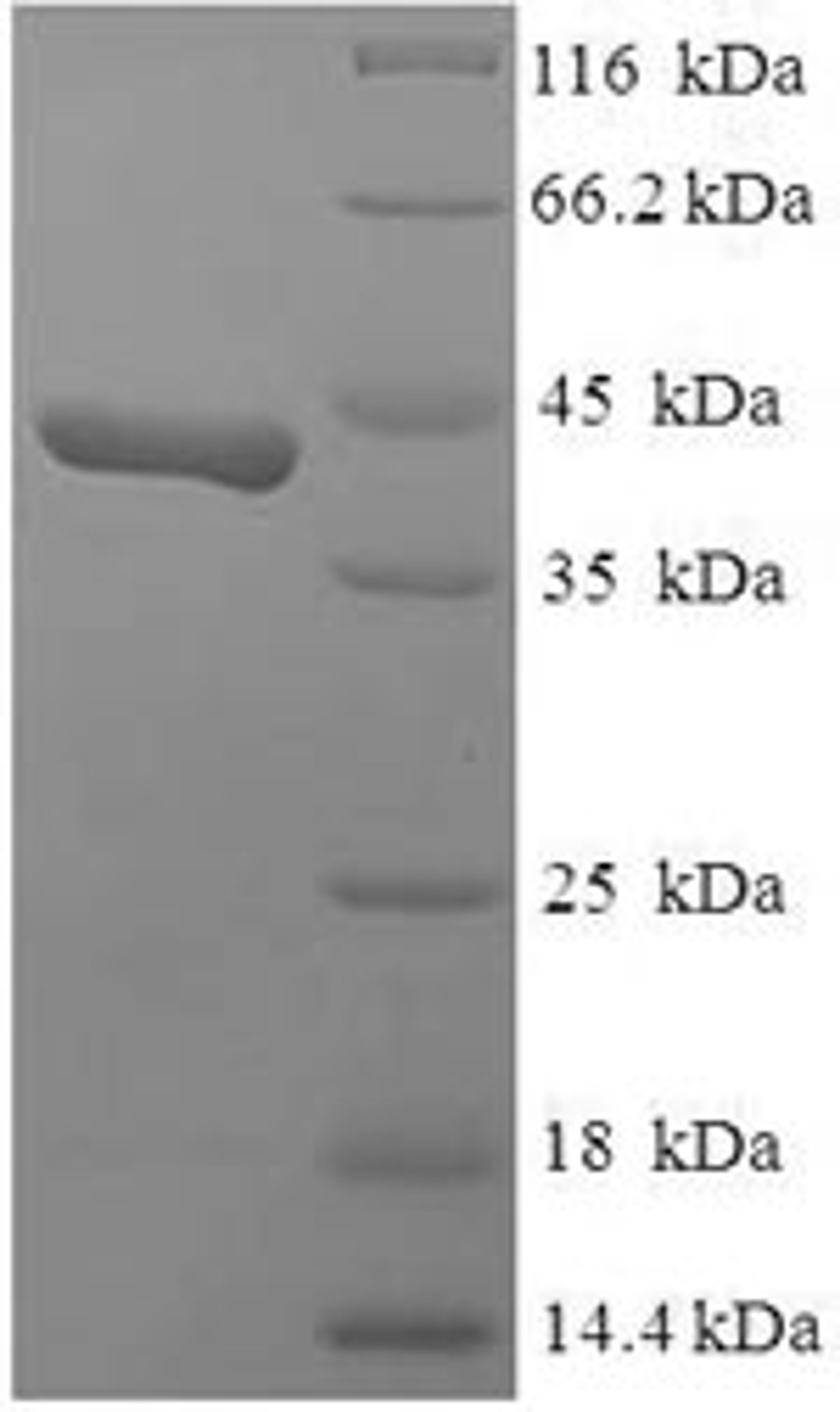 (Tris-Glycine gel) Discontinuous SDS-PAGE (reduced) with 5% enrichment gel and 15% separation gel.