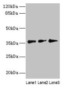 Western blot. All lanes: LDAH antibody at 8µg/ml. Lane 1: Hela whole cell lysate. Lane 2: Jurkat whole cell lysate. Lane 3: A431 whole cell lysate. Secondary. Goat polyclonal to rabbit IgG at 1/10000 dilution. Predicted band size: 38, 33, 23 kDa. Observed band size: 38 kDa