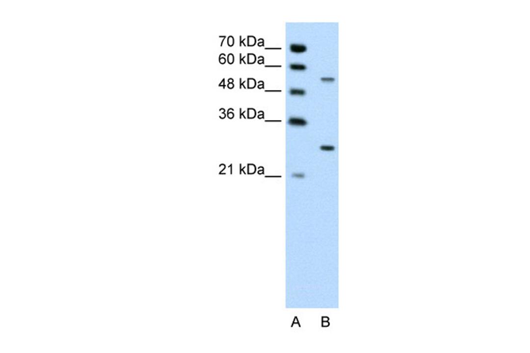 Antibody used in WB on Human Jurkat 0.2-1 ug/ml.