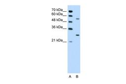 Antibody used in WB on Human Jurkat 0.2-1 ug/ml.