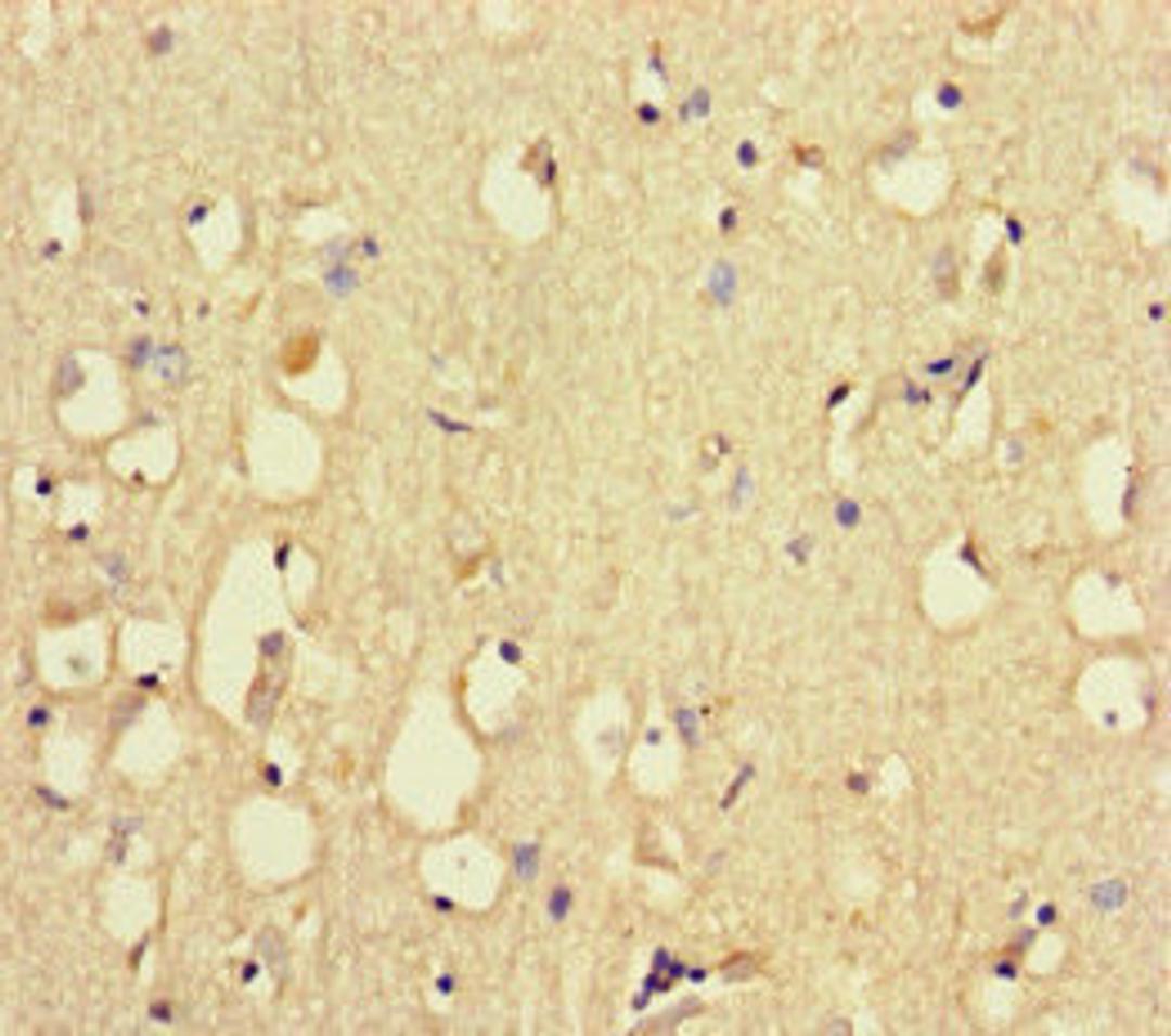 Immunohistochemistry of paraffin-embedded human brain tissue using CSB-PA15139A0Rb at dilution of 1:100