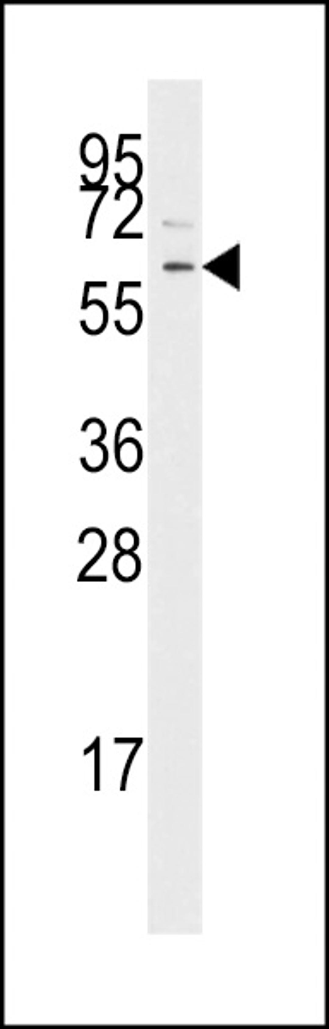 Western blot analysis of anti-TGFBR1 Pab in Jurkat cell line lysates (35ug/lane)