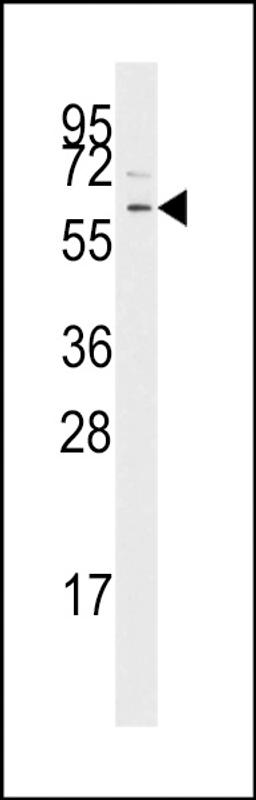 Western blot analysis of anti-TGFBR1 Pab in Jurkat cell line lysates (35ug/lane)