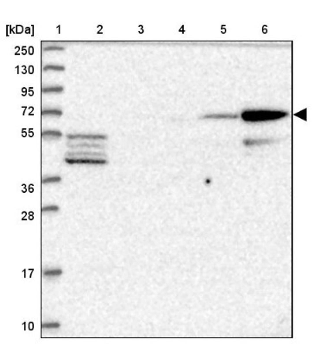 Western Blot: CLIP4 Antibody [NBP1-91793] - Lane 1: Marker [kDa] 250, 130, 95, 72, 55, 36, 28, 17, 10<br/>Lane 2: Human cell line RT-4<br/>Lane 3: Human cell line U-251MG sp<br/>Lane 4: Human plasma (IgG/HSA depleted)<br/>Lane 5: Human liver tissue<br/>Lane 6: Human tonsil tissue