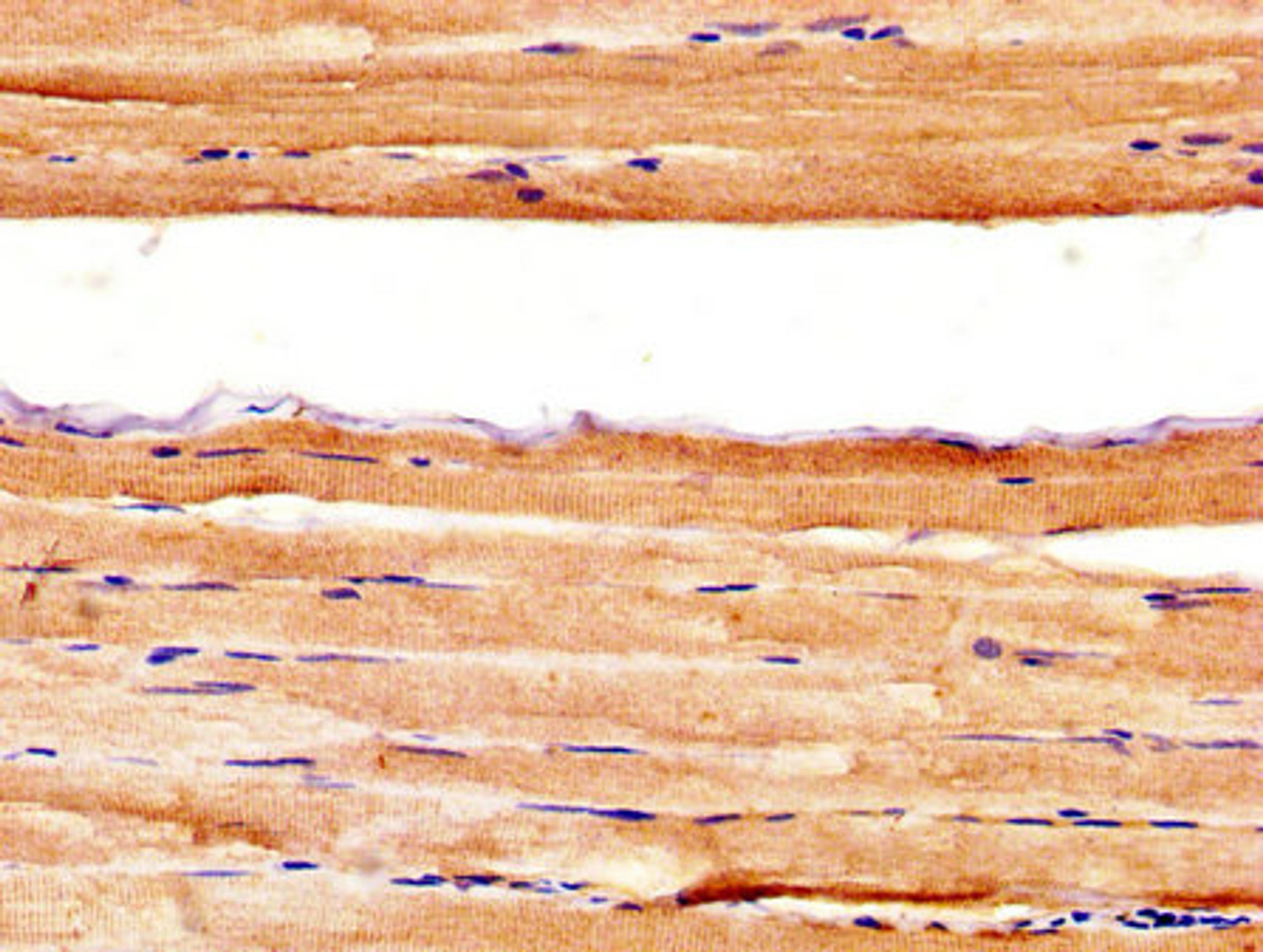 IHC image of CSB-PA326981LA01HU diluted at 1:400 and staining in paraffin-embedded human skeletal muscle tissue performed on a Leica BondTM system. After dewaxing and hydration, antigen retrieval was mediated by high pressure in a citrate buffer (pH 6.0). Section was blocked with 10% normal goat serum 30min at RT. Then primary antibody (1% BSA) was incubated at 4&deg;C overnight. The primary is detected by a biotinylated secondary antibody and visualized using an HRP conjugated SP system.