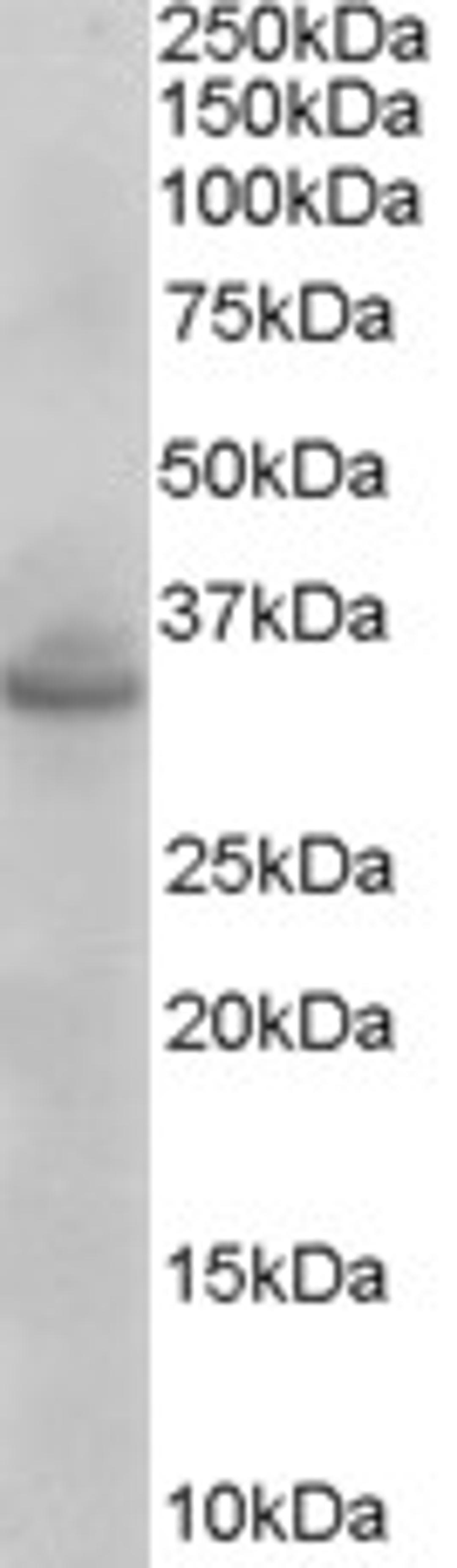 46-448 (0.003ug/ml) staining of Mouse Brain lysate (35ug protein in RIPA buffer). Primary incubation was 1 hour. Detected by chemiluminescence.