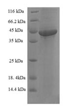 (Tris-Glycine gel) Discontinuous SDS-PAGE (reduced) with 5% enrichment gel and 15% separation gel.