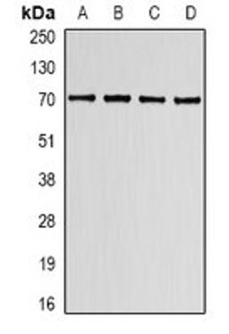 Western blot analysis of K562 (Lane1), HT29 (Lane2), mouse spleen (Lane3), mouse lung (Lane4) whole cell lysates using LBR antibody