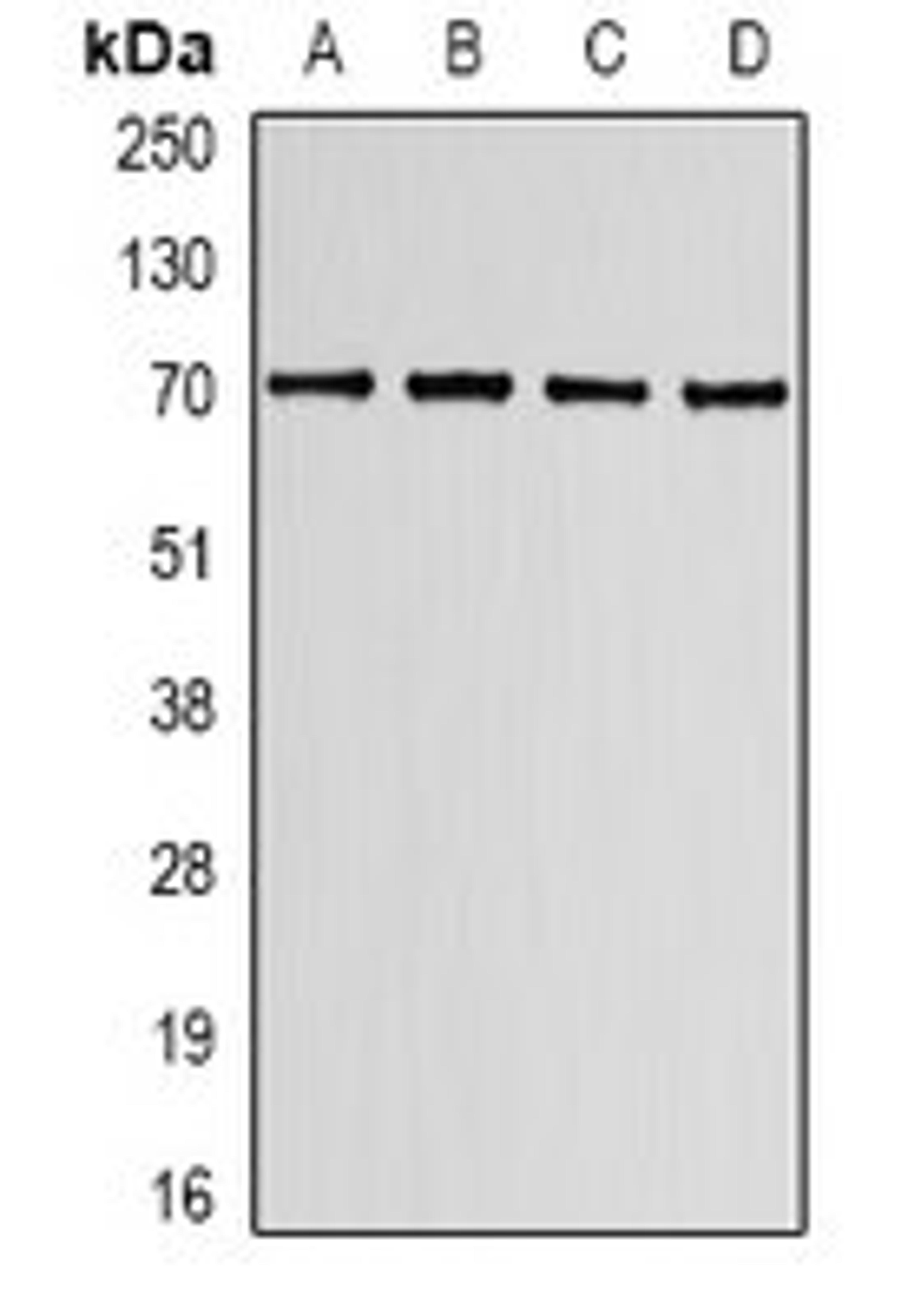 Western blot analysis of K562 (Lane1), HT29 (Lane2), mouse spleen (Lane3), mouse lung (Lane4) whole cell lysates using LBR antibody