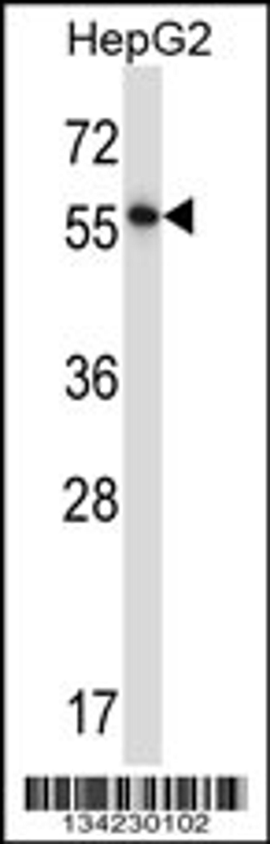 Western blot analysis in HepG2 cell line lysates (35ug/lane).