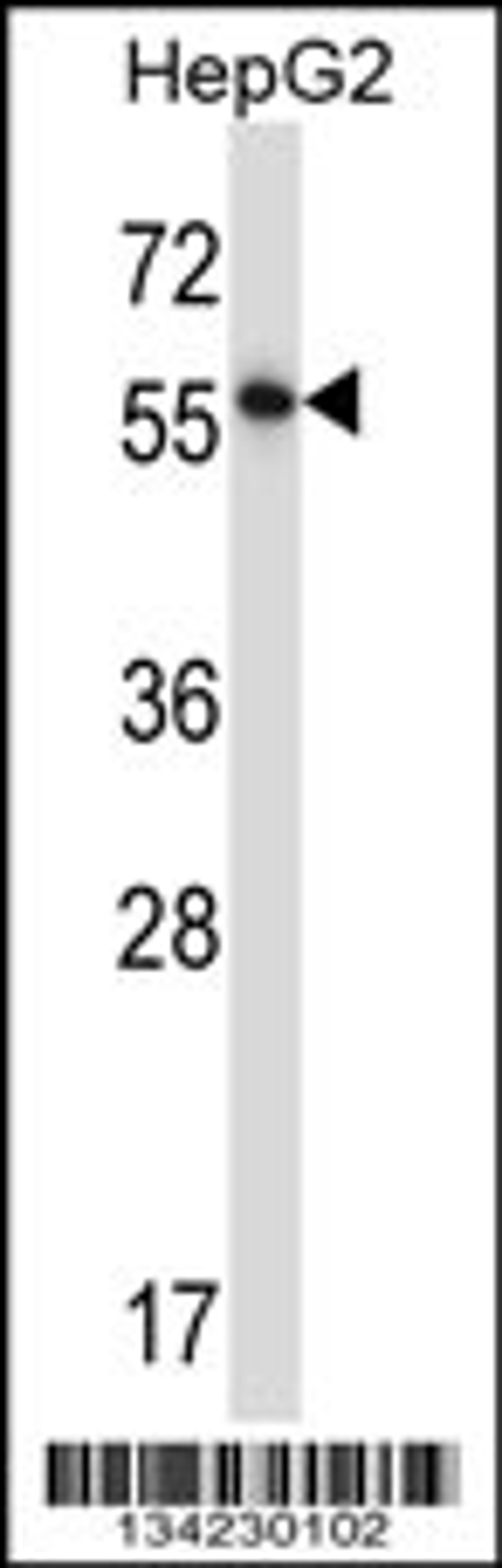 Western blot analysis in HepG2 cell line lysates (35ug/lane).