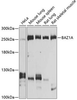 Western blot - BAZ1A antibody (A9866)