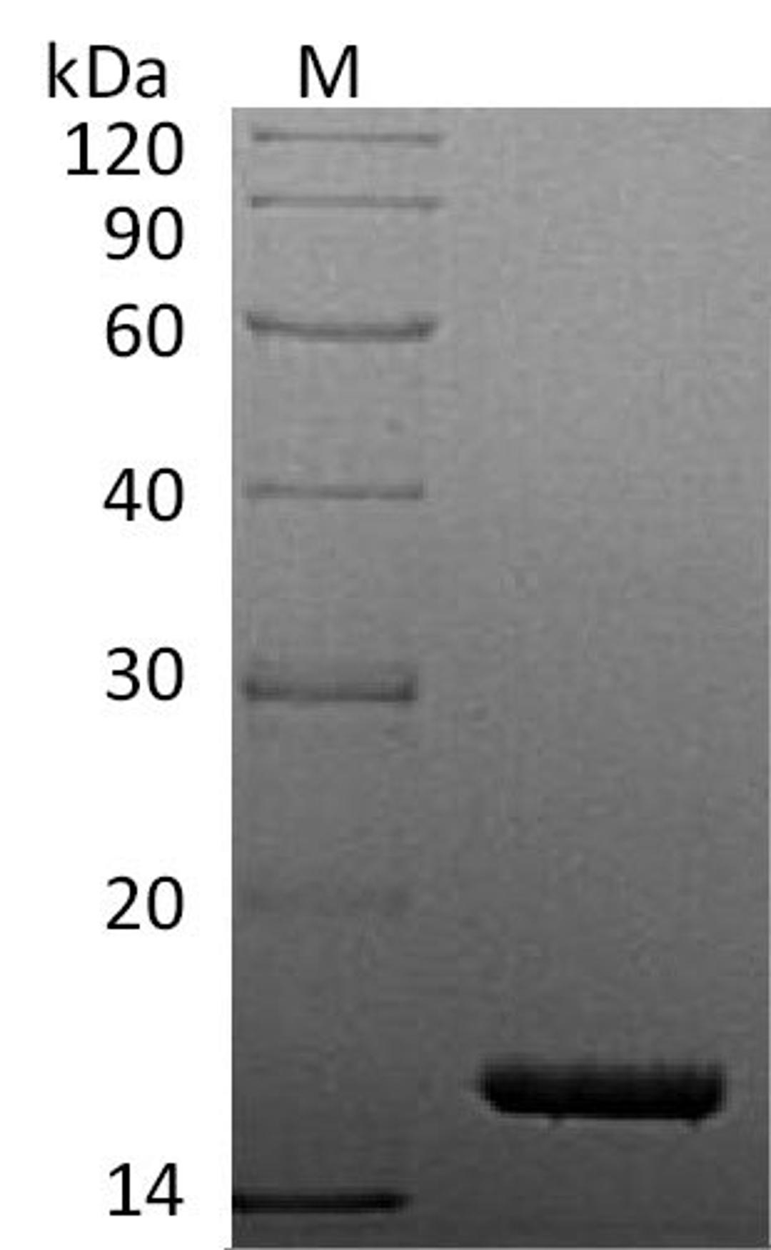 (Tris-Glycine gel) Discontinuous SDS-PAGE (reduced) with 5% enrichment gel and 15% separation gel.