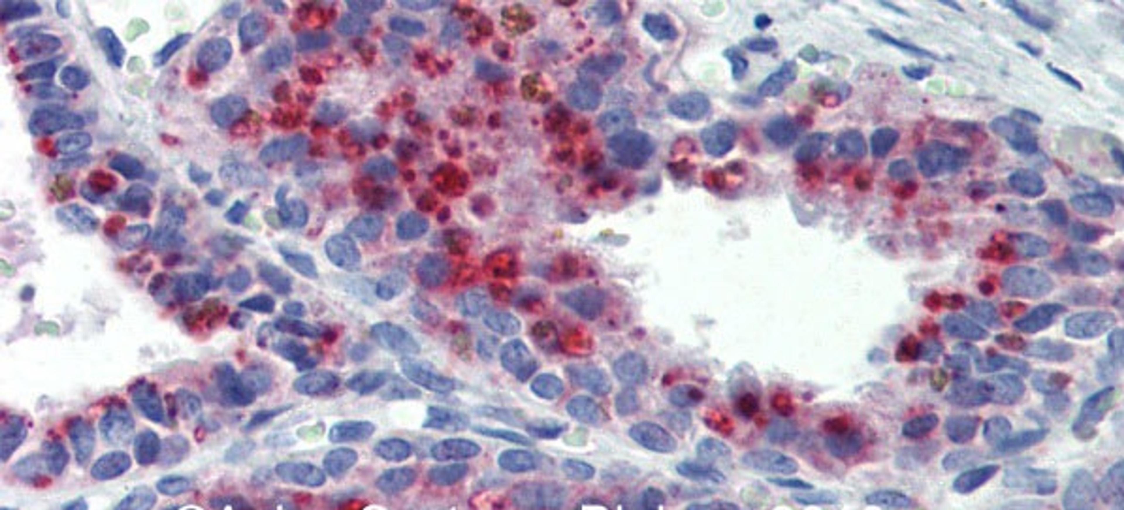 Antibody used in IHC on Human Prostate at 5.0 ug/ml.