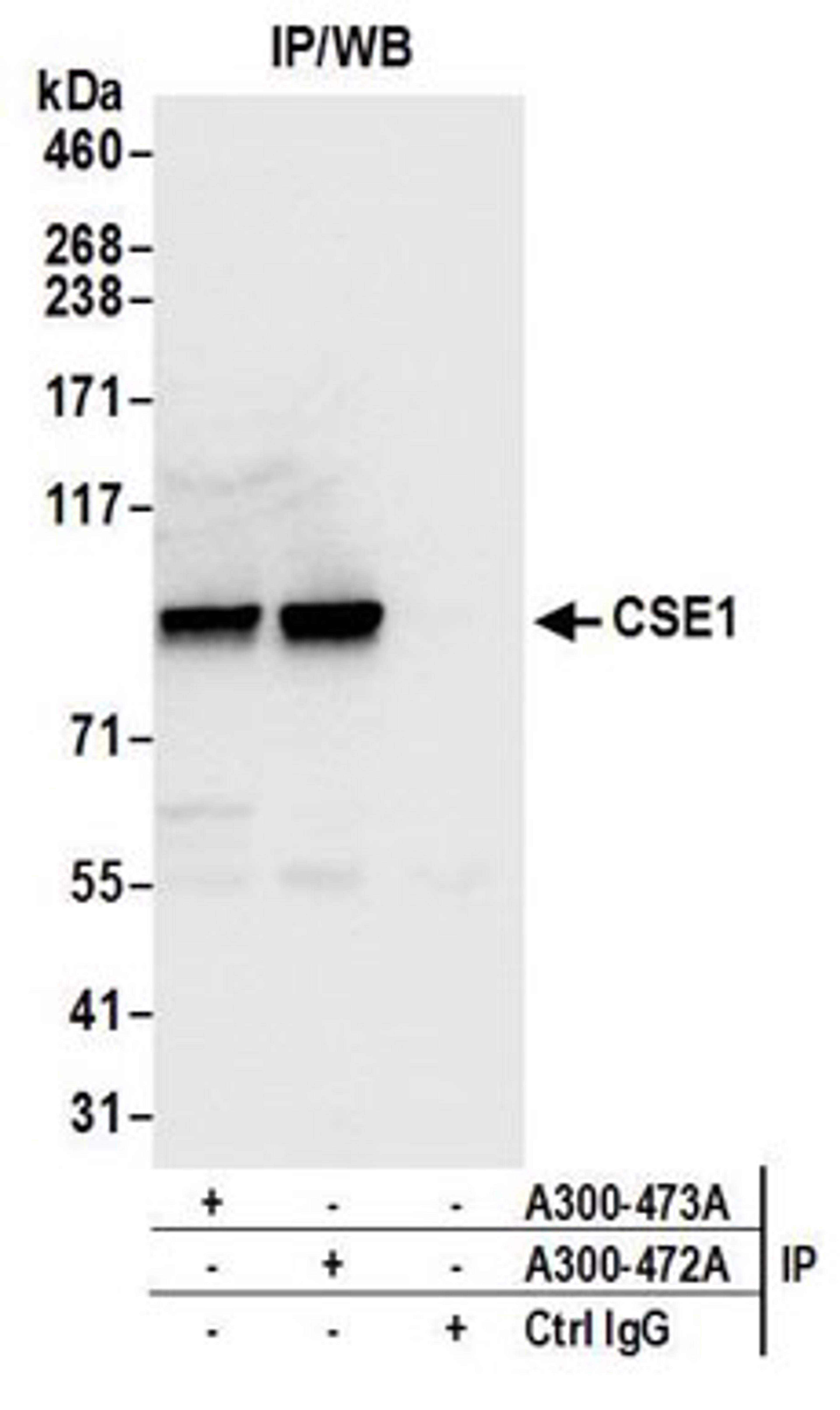 Detection of human CSE1 by western blot of immunoprecipitates.