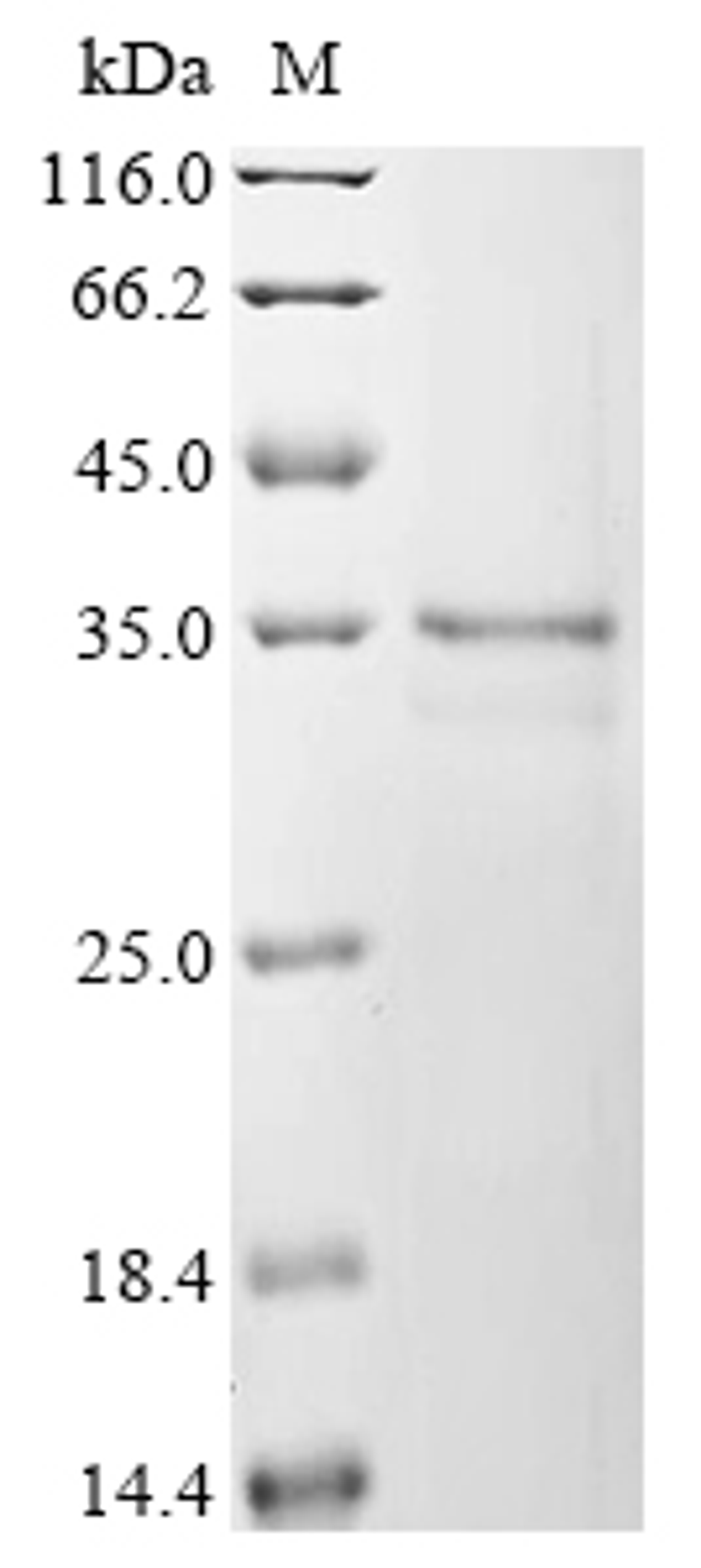 (Tris-Glycine gel) Discontinuous SDS-PAGE (reduced) with 5% enrichment gel and 15% separation gel.