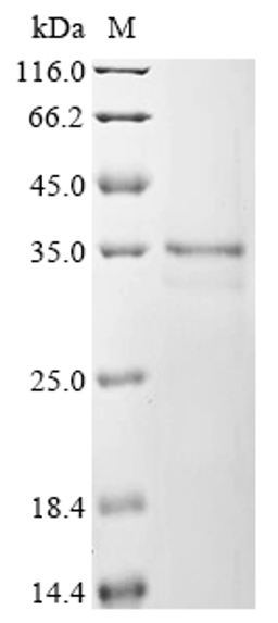 (Tris-Glycine gel) Discontinuous SDS-PAGE (reduced) with 5% enrichment gel and 15% separation gel.