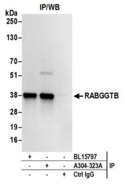 Detection of human RABGGTB by western blot of immunoprecipitates.