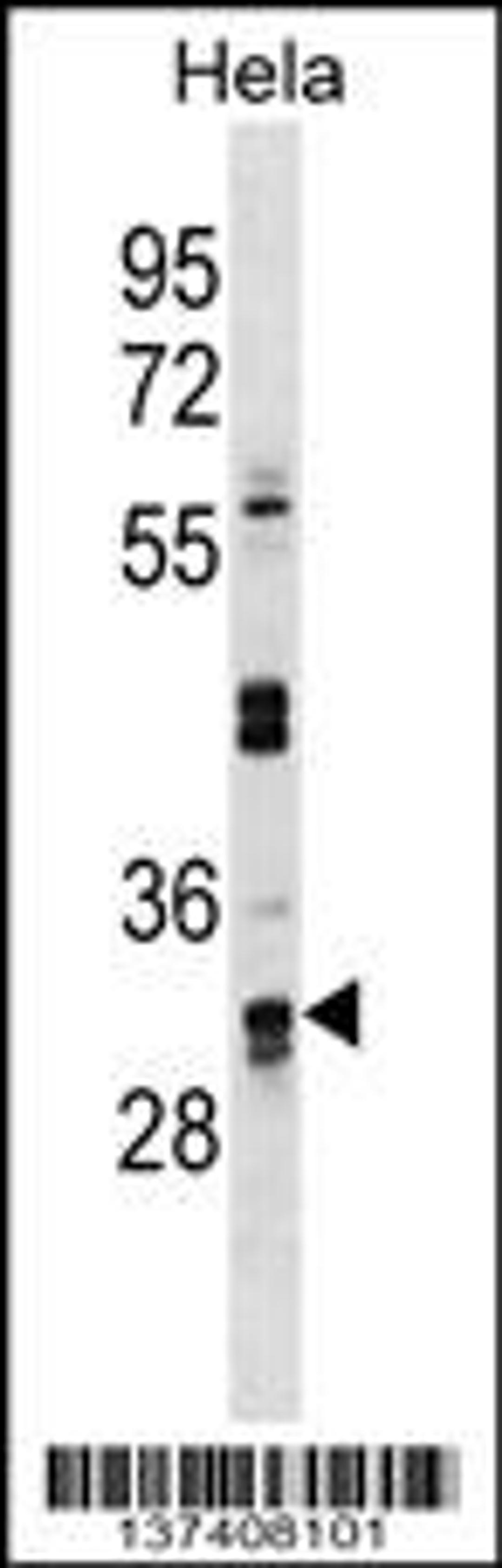 Western blot analysis in Hela cell line lysates (35ug/lane).