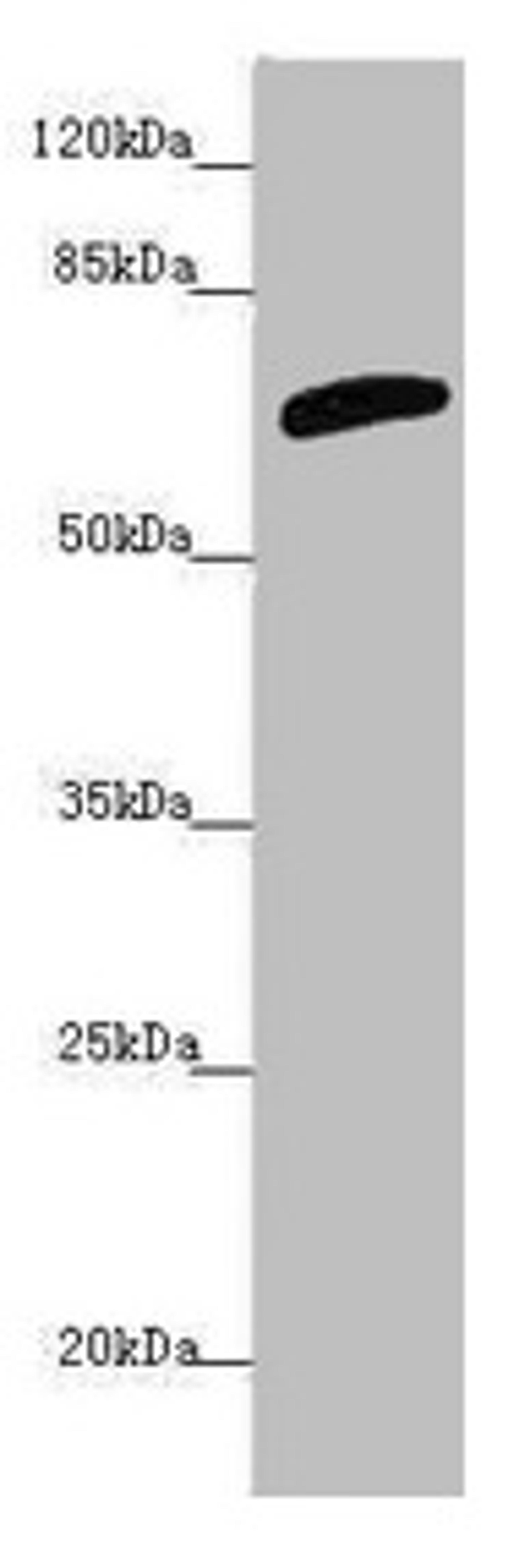 Western blot. All lanes: SLC6A12 antibody at 4.47µg/ml + PC-3 whole cell lysate. Secondary. Goat polyclonal to rabbit IgG at 1/10000 dilution. Predicted band size: 70 kDa. Observed band size: 70 kDa