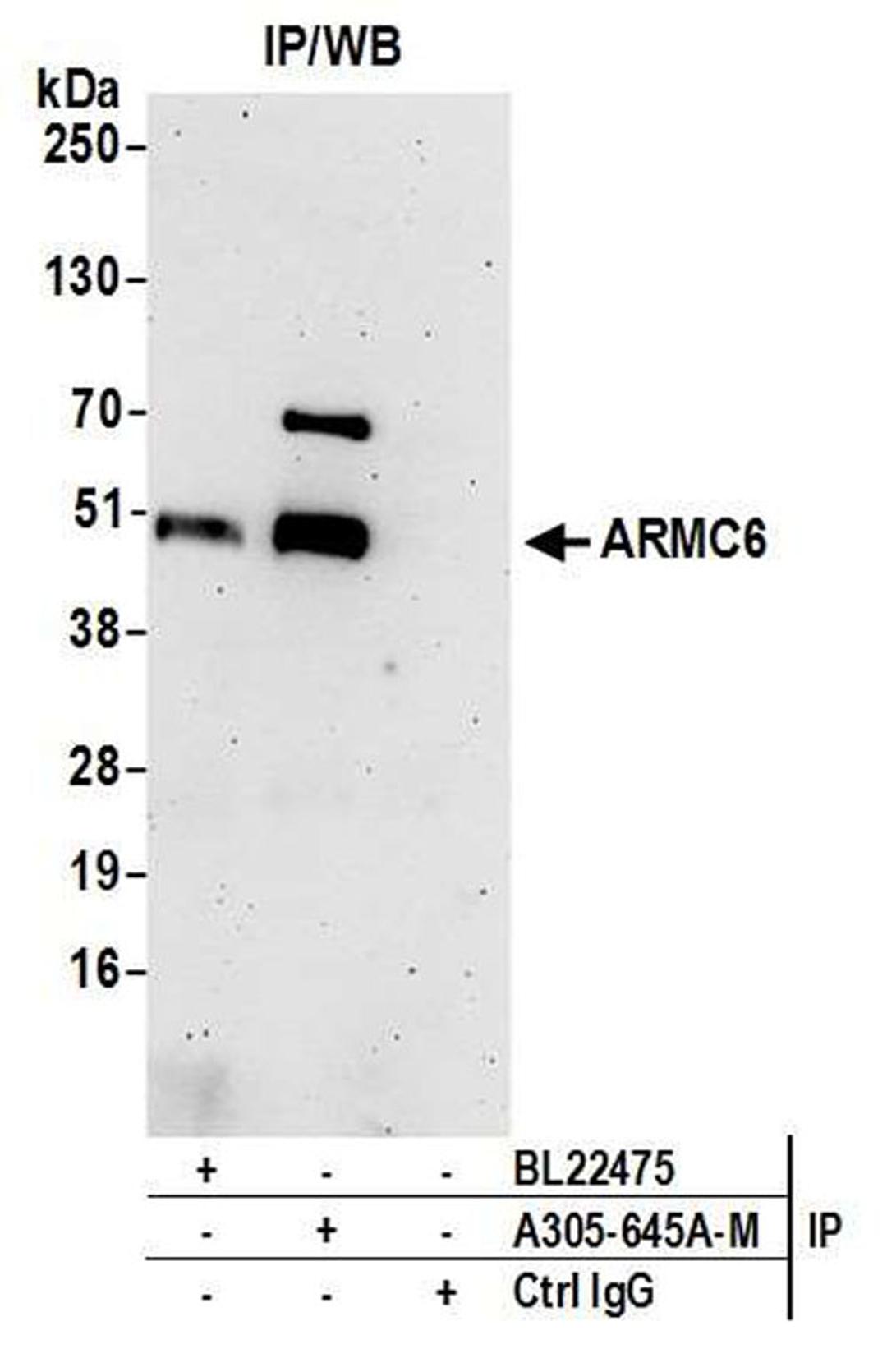 Detection of human ARMC6 by WB of IP.