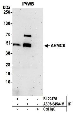 Detection of human ARMC6 by WB of IP.