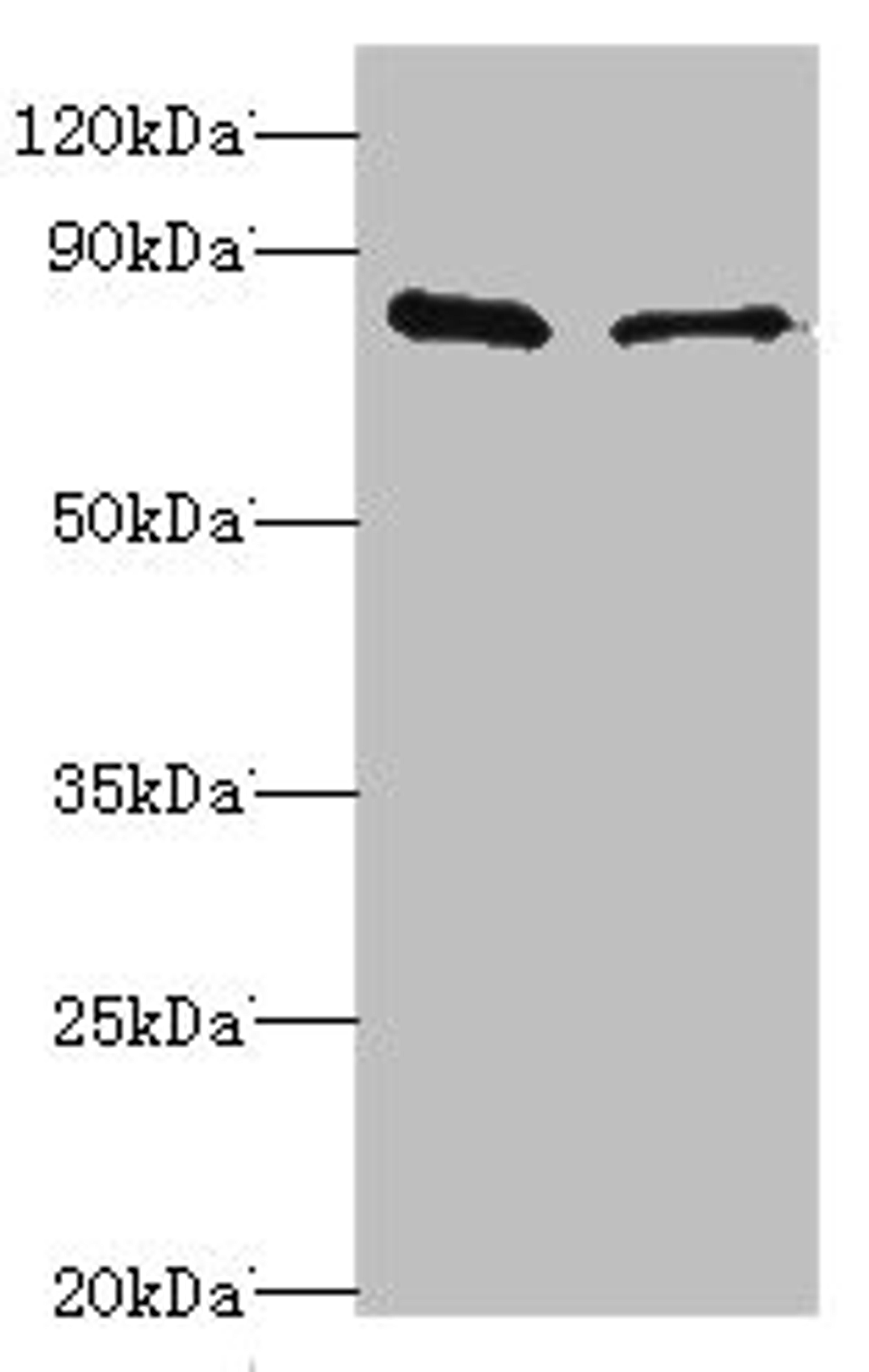 Western blot. All lanes: SLC39A6 antibody at 10ug/ml. Lane 1: Hela whole cell lysate. Lane 2: 293T whole cell lysate. Secondary. Goat polyclonal to rabbit IgG at 1/10000 dilution. Predicted band size: 86, 49 kDa. Observed band size: 86 kDa.