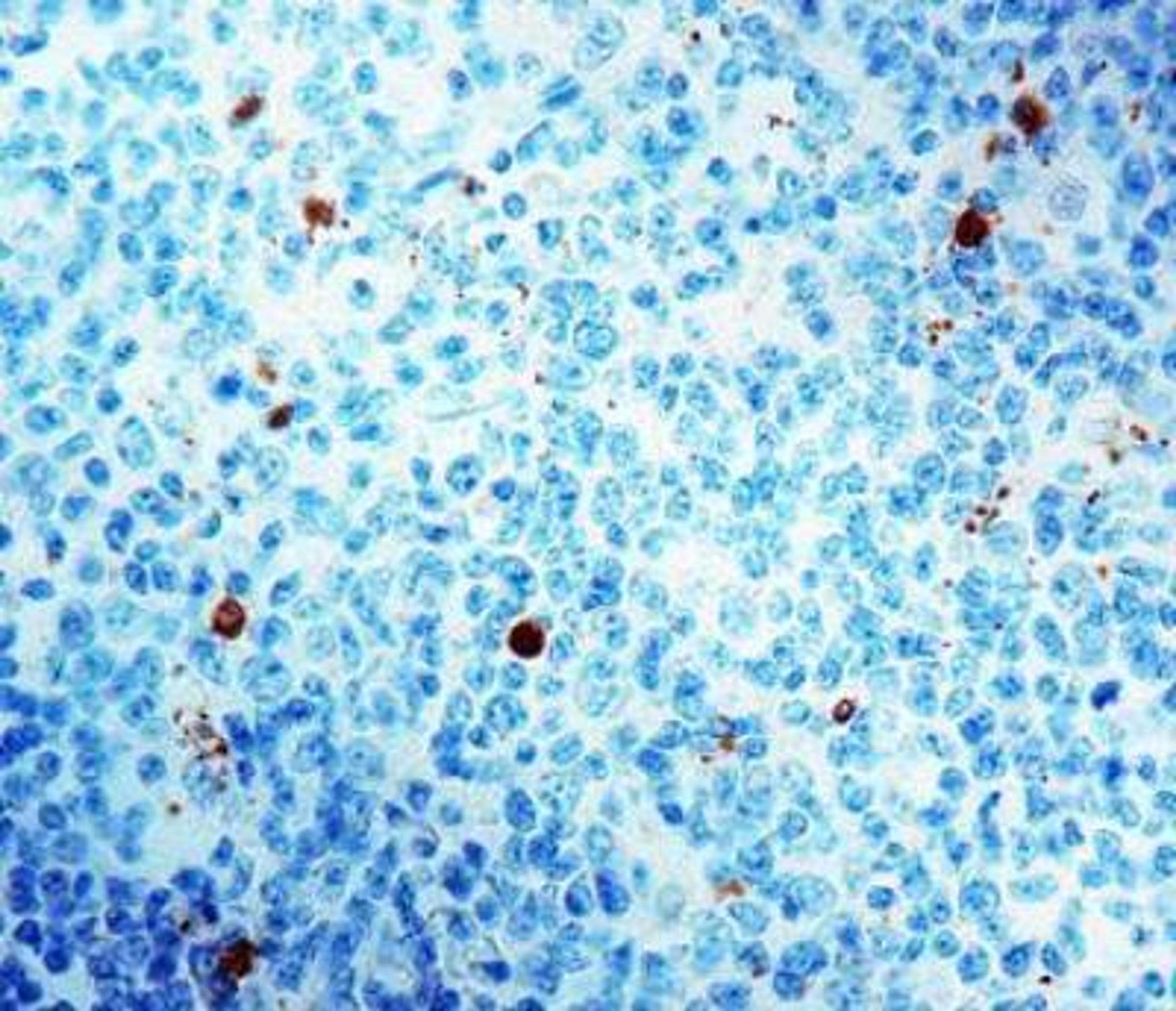 Immunohistochemistry-Paraffin: Caspase-3 Antibody [NB600-1235] - Human tonsil.