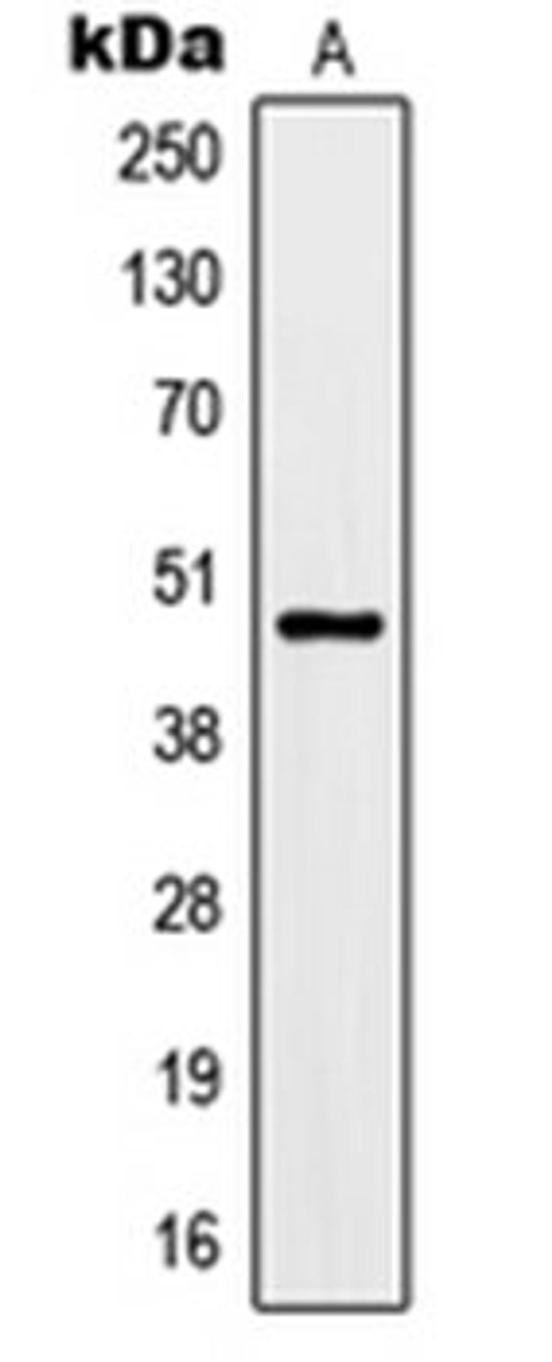 Western blot analysis of rat brain (Lane 1) whole cell lysates using KCNJ9 antibody