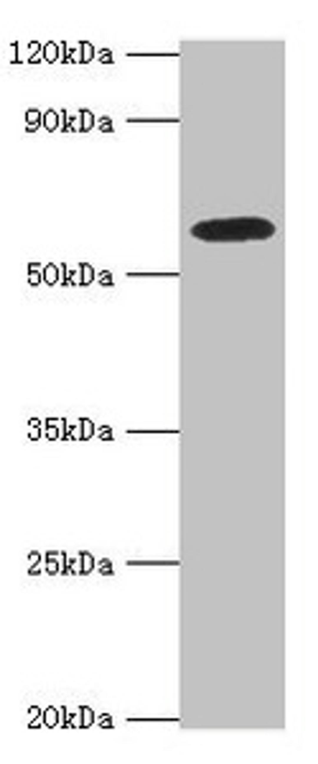Western blot. All lanes: STXBP4 antibody at 10ug/ml + PC-3 whole cell lysate. Secondary. Goat polyclonal to rabbit IgG at 1/10000 dilution. Predicted band size: 62, 27 kDa. Observed band size: 62 kDa. 
