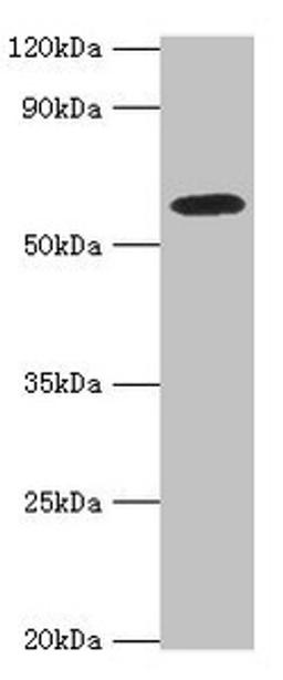 Western blot. All lanes: STXBP4 antibody at 10ug/ml + PC-3 whole cell lysate. Secondary. Goat polyclonal to rabbit IgG at 1/10000 dilution. Predicted band size: 62, 27 kDa. Observed band size: 62 kDa. 