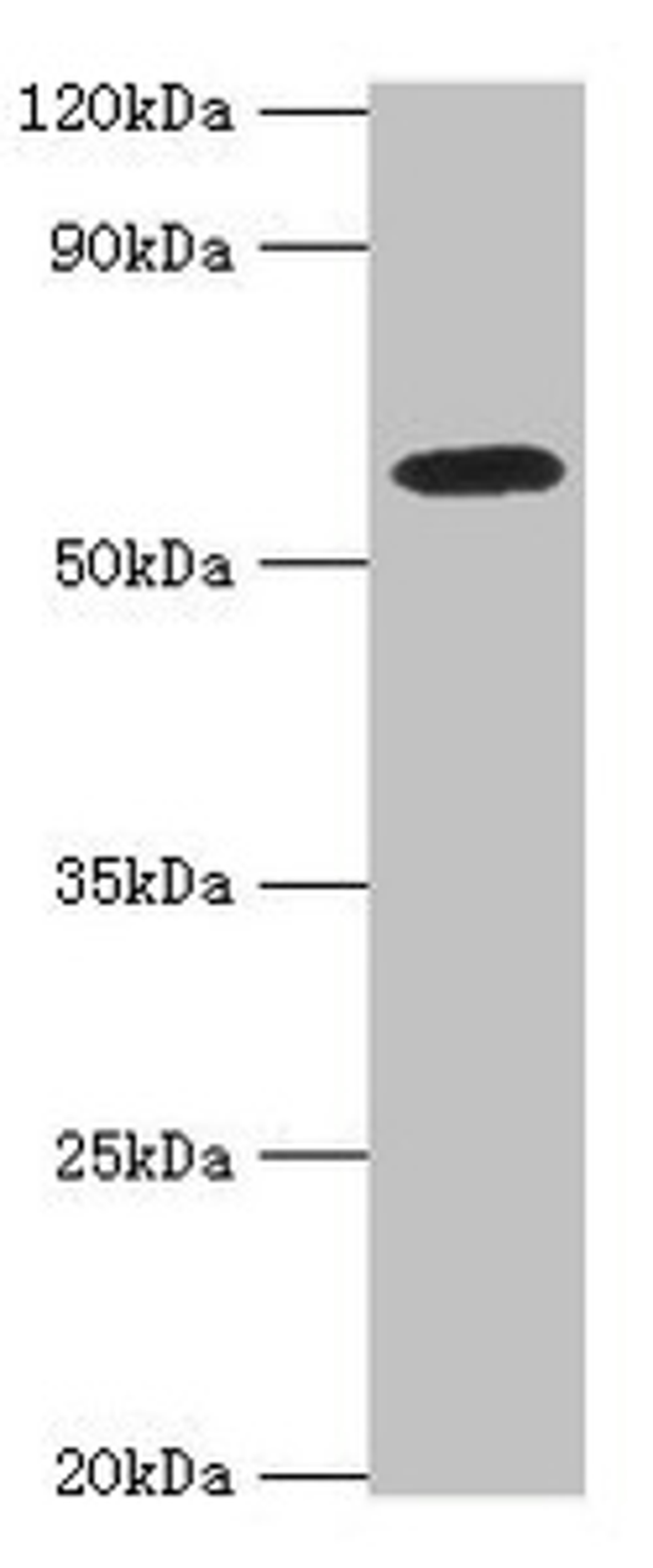 Western blot. All lanes: STXBP4 antibody at 10ug/ml + PC-3 whole cell lysate. Secondary. Goat polyclonal to rabbit IgG at 1/10000 dilution. Predicted band size: 62, 27 kDa. Observed band size: 62 kDa. 