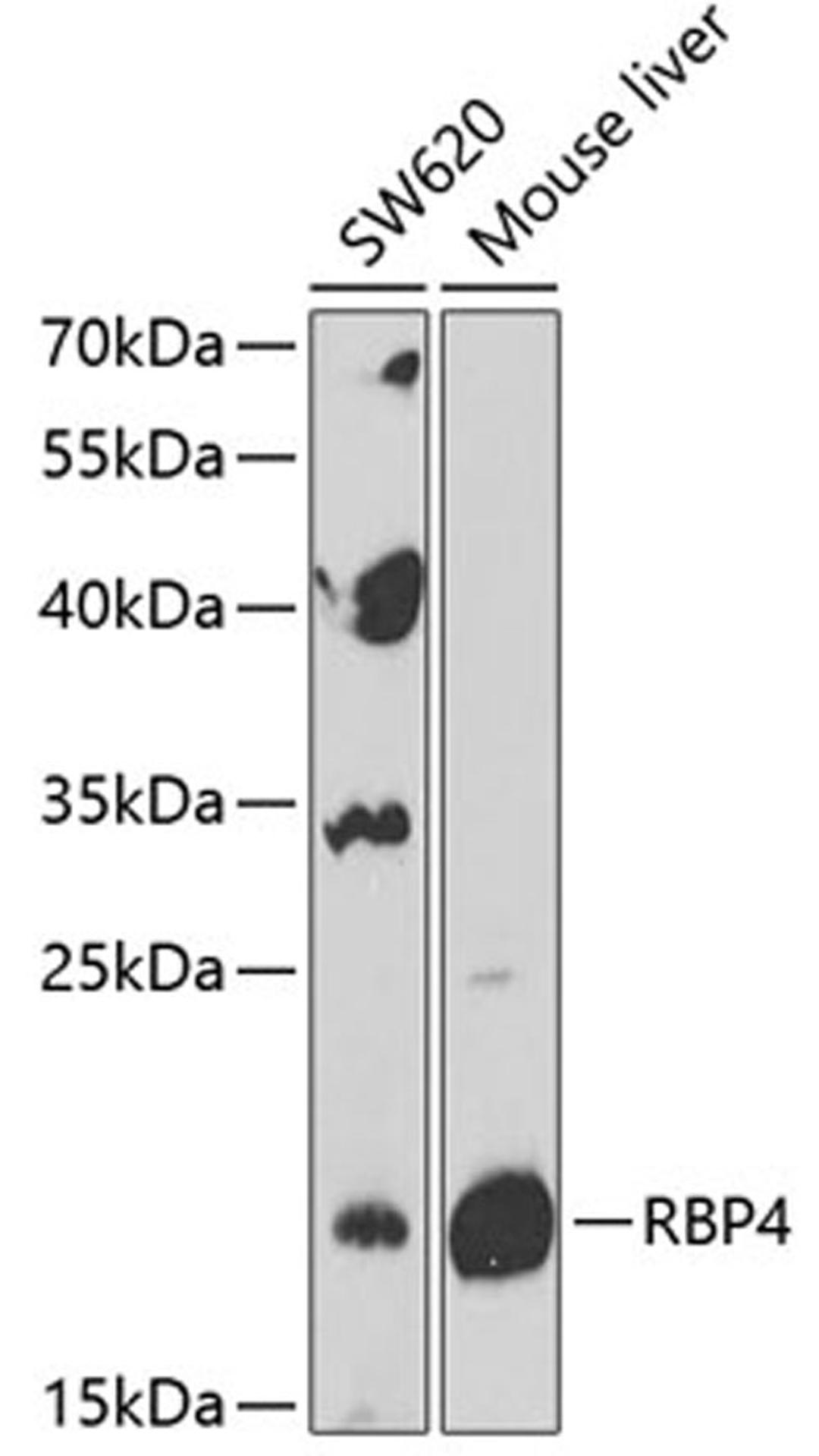 Western blot - RBP4 Antibody (A12495)