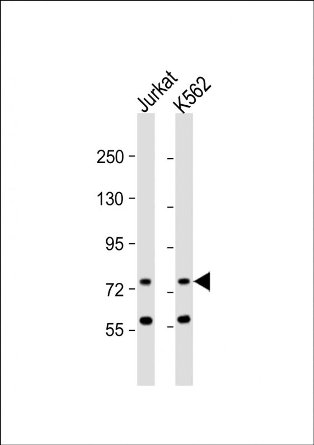 Western Blot at 1:1000 dilution Lane 1: Jurkat whole cell lysate Lane 2: K562 whole cell lysate Lysates/proteins at 20 ug per lane.