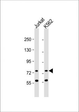 Western Blot at 1:1000 dilution Lane 1: Jurkat whole cell lysate Lane 2: K562 whole cell lysate Lysates/proteins at 20 ug per lane.